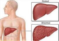  کبدتان را چقدر می‌شناسید؟ 